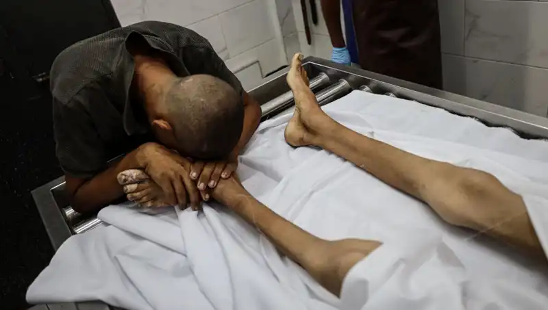 Gazze'de Açlık Sınırında Hayatta Kalma Mücadelesi: Bir Çocuğun Trajik Hikayesi