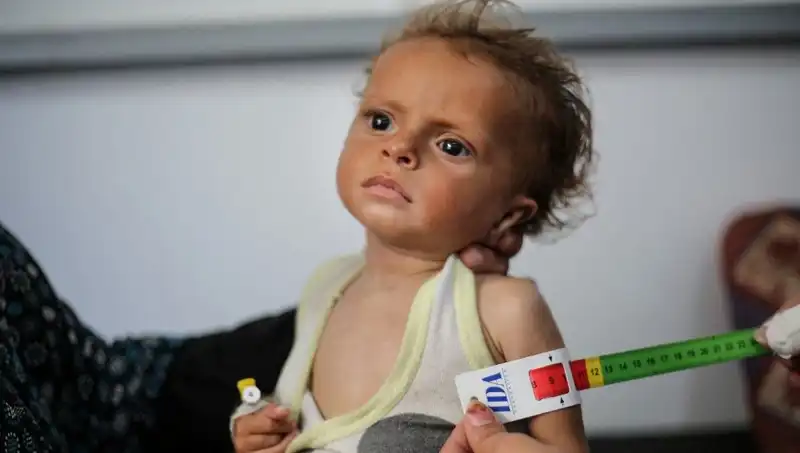 İngiltere, 300 Gazzeli Çocuğa Gelecek Sunuyor: Yeni Bir Umut
