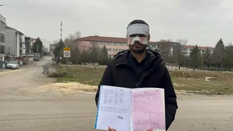 Öğretmenin Öğretmene Yaptığı İnanılmaz Olay: Yüzüne Sıcak Çay Fırlatıldı!